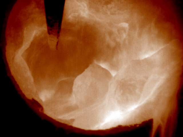 DIAS_infrared_thermal_image_zinc_recycling_temperature_kiln_combustionchamber_PYROINC_infraredcamera.jpg DIAS_infrared_thermal_image_zinc_recycling_temperature_kiln_combustionchamber_PYROINC_infraredcamera.jpg